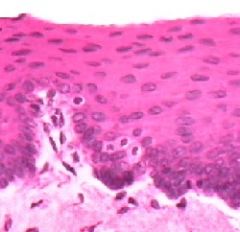 This epithelial tissue was found in the mouth. It is ___ ___ epithelium.