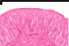 This tissue lines the urinary bladder. It is ______ epithelium.