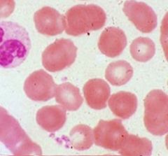 These erythrocytes are a major part of ____ connective tissue