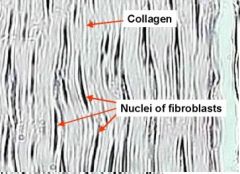 This organized tissue of fibers with few cells is an example of _____ connective tissue