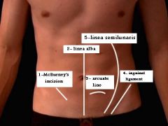marks lateral border of rectus abdominis 