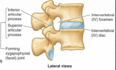 -anterior portion of verebrae
-gives column strength, supports body weight
-spongy bone surrounded with think layer of compact bone
-held together by intervertebral discs (fibrocartilage) and ligaments
-column of bodies and discs creates flexi...