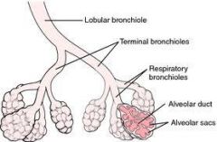Abnormal permanent dilation and wall destruction of the air space distal to the terminal bronchiole
