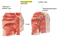 1. Auditory tube (and sapinopharyngeus muscle which opens it)2. Pharyngeal tonsil3. Uvula