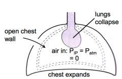Intra-pleural pressure would be normalised with atmospheric pressure

Lungs would collapse due to inward recoil

Chest wall would expand due to outward recoil 

