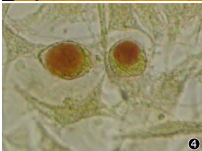 -McCoy cells with iodine or DFA staining vacuole
-Elementary bodies = small extracellular bodies