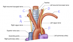 What is branch is structure 'A' of the aortic arch?