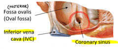 Yes the coronary veins accompany the coronary arteries. They drain into the coronary sinus which is located next to the IVC