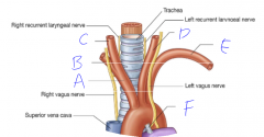 What is branch is structure 'E' of the aortic arch?