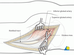 3-superficial dissection to acet(KLB)/hip(M/S) (7 steps)
