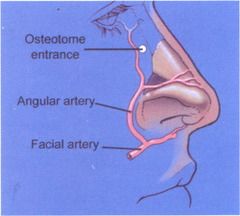ECA -> Facial artery, splits into:
1. Superior Labial Artery: columella, lateral nasal wall
2. Angular Artery: nasal side wall, tip, dorsum