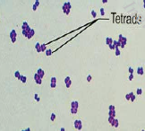 Micrococcus:
gram positive cocci in tetrads