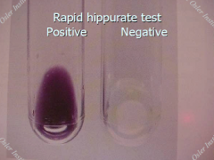 Group B strep = S. agalactiae
beta hemolytic
Catalase negative
CAMP test +
Hippurate + (purple)
Penicillin, Vanco S