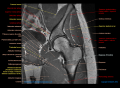 The medial femoral circumflex artery and first perforating branch of the profunda femoris artery anastamose at which of the following locations?  
1.  Medial to the gluteus medius insertion 
2.  Medial to the gluteus maximus insertion 
3.  Ante...