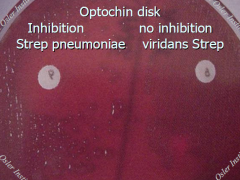 Alpha Hemolytic Streptococcus
 
-Optochin = ethyl hydrocupreine hydrochloride