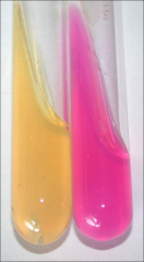 a) Fuchsia color + Urease hydrolysis of urea produces ammonia 
b) Yellow - for Urease/negative control