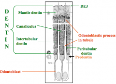 Enamel spindles


Peritubular dentin
Intertubular dentin
