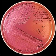 










Deoxycholate agar: differential and
selective media for entrics 