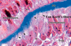 von Korff's fibers
-made of Collagen III fibers and fibronectin