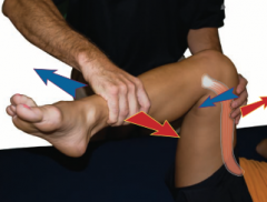 Hip flexion, external rotation, and abduction with knee flexion