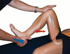 Knee flexion and tibial external rotation