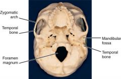 a) Mandibular fossa of the temporal bone
b) mandibular condyle of the madible.
c) held together by ligaments