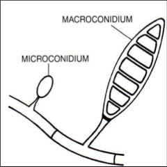 Macroconidia



Epidermophyton
sp.      