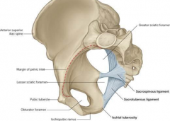 - ischial spine
- sacrum

divides sciatic foramen to greater and lesser