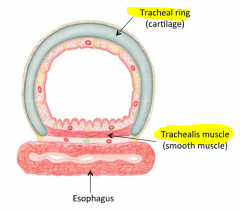 Tracheal ring (cartilage)
- horseshoe shape
Trachealis muscles (smooth muscle)
- encloses posterior surface