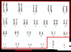 Any of the numbered chromosomes.