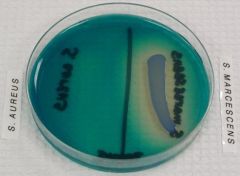 What test is this?


 


Which is a positive result?


 


What are you looking for?


 


What does this agar contain?