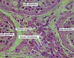   Tissu interstitiel coloré observé au microscope optique ( testicule cryptorchide )   