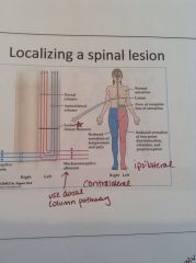 If you cut all the fibers on the L side of the spine, pt will have reduced sensation of temp and pain on R side, but on ipsilateral side pt will have reduced sensation of 2pt discrimination, vibration, and proprioception. Work through picture.