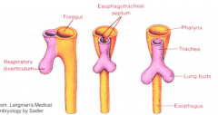 - endoderm lining of foregut makes a groove: laryngotracheal diverticulum
- diverticulum pinch inwards to create tracheosophageal ridges
- ridges fuse to create tracheoesophogeal septum