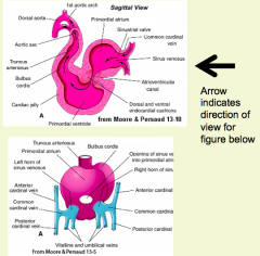 - Opens into its own side of the primordial or common atrium (R horn --> R side; L horn --> L side)
- Soon a common SV opens into the primordial atrium at the Sinoatrial opening
- Sinoatrial opening flanked by R and L valves