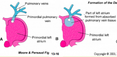 - Smooth part: absorbed Pulmonary Veins
- Trabeculated part + Auricle: Primitive Atrium