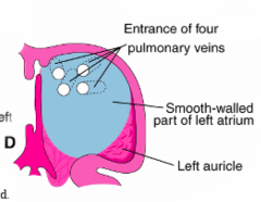 - 1 Pulmonary Vein
- Connects w/ pulmonary vascular plexus associated w/ branching lung buds
- Initial pulmonary veins are absorbed into primordial L atrium to become smooth part of definitive L atrium
- Eventually 4 pulmonary veins form