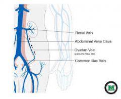 Left renal vein blockage