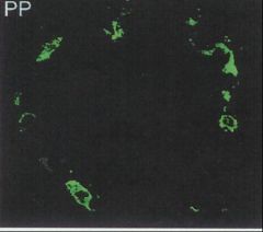 What cells are stained in this image?