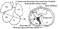 Primary Interventricular Foramen (IVF)
