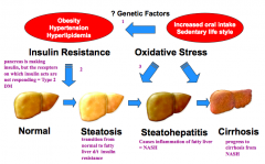 1. Increased oral intake, sedentary lifestyle, genetic factors leads to obesity, HTN, and hyperlipidemia
2. Obesity, HTN, and hyperlipidemia lead to insulin resistance which causes fatty liver changes (steatosis)
3. Oxidative stress causes infla...