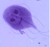 In kingdom Diplomonadida. Unicellular flagellate. Responsible for intestinal disease that causes diarrhea.