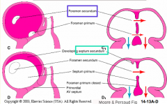 Closure of Primary Atrial Foramen:
- Dorsal mesocardial projection / vestibular spine merges w/ mesenchyme cap of the primary atrial septum and the cushion tissue forming the septum intermedium