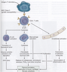 1. Immune complex mediated inflammation [plasma cells in synovium produce IgM, IgG (Rheumatoid factors) against Fc portion of IgG]. These complexes formed activate complement, trigger release of PMNs, macrophages with inflammation

2. Pannus for...