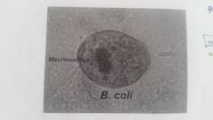 Balantidiasis
Kidney shaped macronucleus
Transmitted by ingesting contaminated food or water
May puncture the bowel