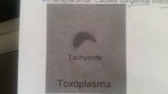 Toxoplasmosis
Trophozioite: Tachyzoite
Ingest oocyst in food or water
Inhalation of dried fecal material containing oocyst "Cats"
Transplacental: Congenital infection--brain damage, convulsions, blindess, or death