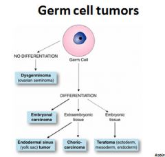 Germ cell tumors constitute approximately 20% to 30% of
all ovarian neoplasms. They are thought to be derived from
primitive totipotent germ cells and may appear to be undifferentiated
(dysgerminoma) or high-grade anaplastic carcinoma
(embryonal c...