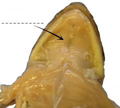 A very thin sheet of muscle at the ventral surface of the floor of the mouth.