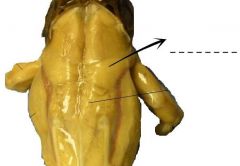 A small muscle overlapping the caudal portion of the suprascapula.