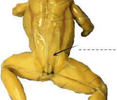 A narrow muscle located posteriorly to the longissimus dorsi and extends posterior in oblique position.